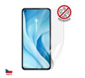 Screenshield Anti-Bacteria XIAOMI 11 Lite 5G NE folie na displej foto